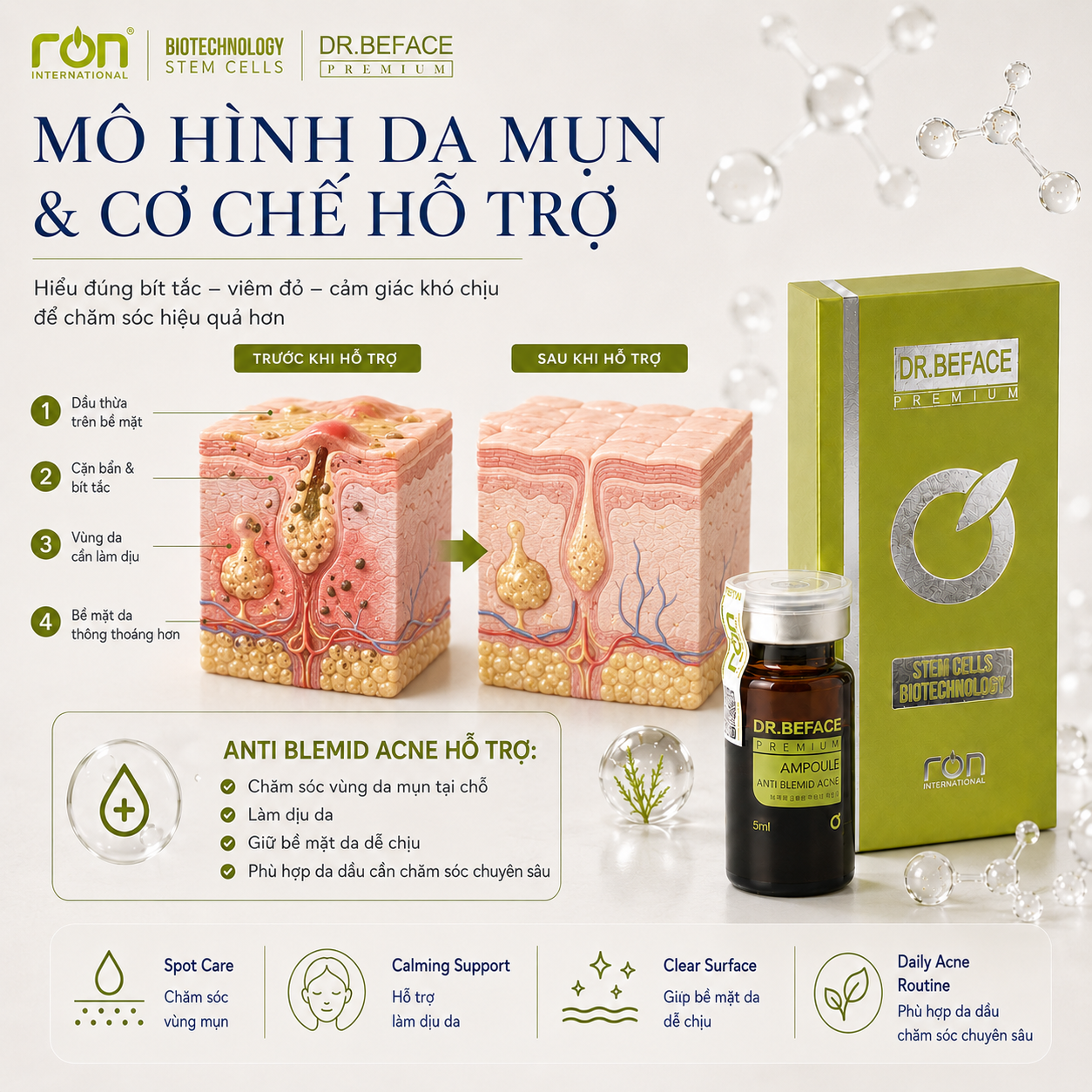 DR.BEFACE ANTI BLEMID ACNE 5ML – TINH CHẤT CHĂM SÓC DA DẦU, DA DỄ NỔI MỤN – 5ml/lọ